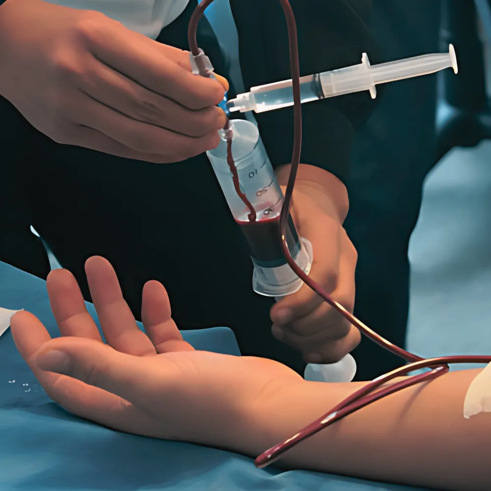 Autohemoterapia Menor